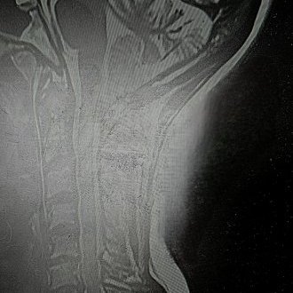 Comme une traînée de poudre